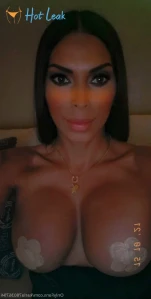 10158529