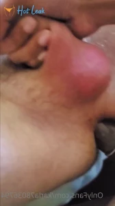 10375858