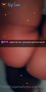 10375864