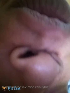 10375657