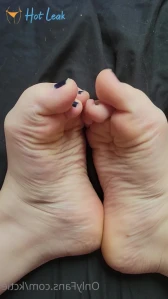 10372420