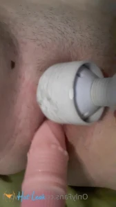 10372356