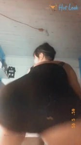 10361304