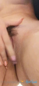 10360531