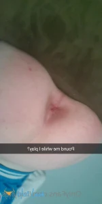10343378