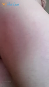 10342872