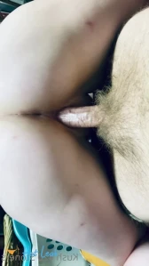 10157177