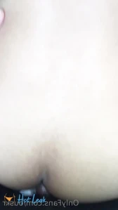10125310