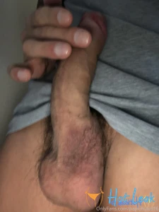 11642582