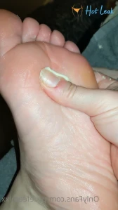 10100279