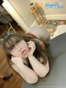 11872387