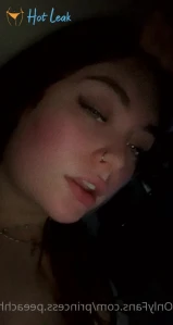 10083518