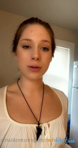10081133