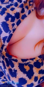 9915729