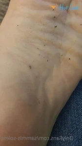 10008501