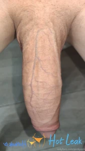 11924396