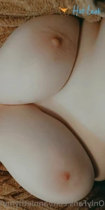 11373867