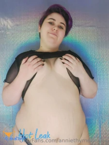 11574420