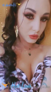 11440484