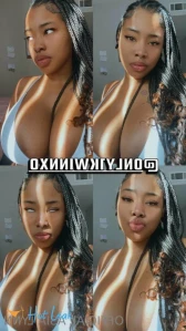11340359