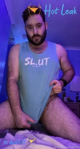 11587636