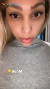 11332611