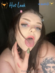 11655386