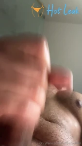 11418931