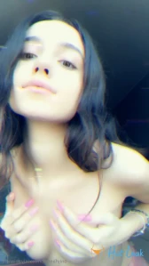 11403295