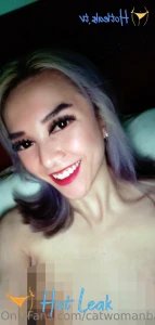 11803728