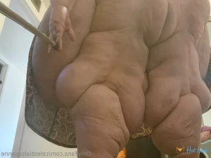 11407690