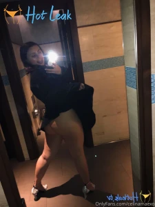 11644398