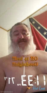 11301393