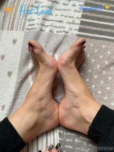 11893885