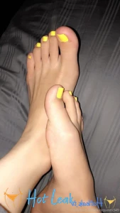 11794756
