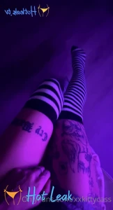11612388