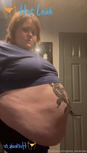 11807171