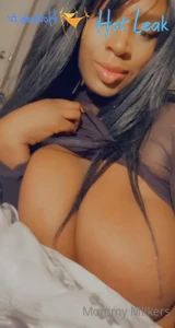 11935046