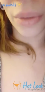 11586593