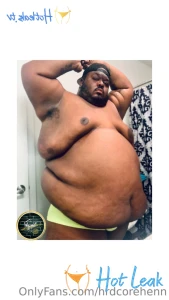 11561771