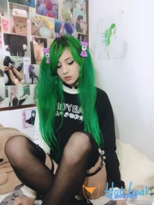 11866887