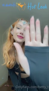 11725456