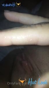 11865144