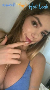 11655970