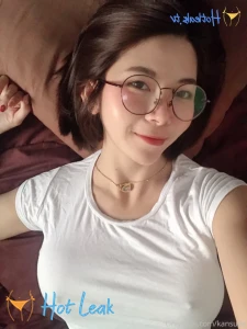 11610312