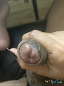 11203321