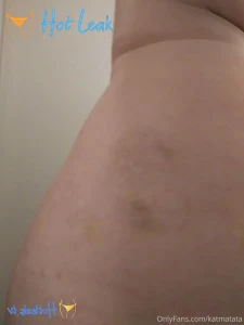 11487315