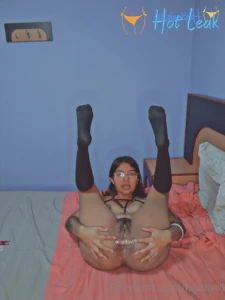 11821556