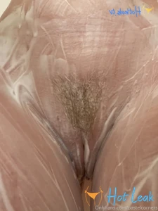 11793781