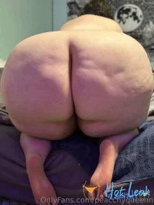 11932076